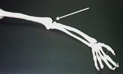 [Skeletal Arm]